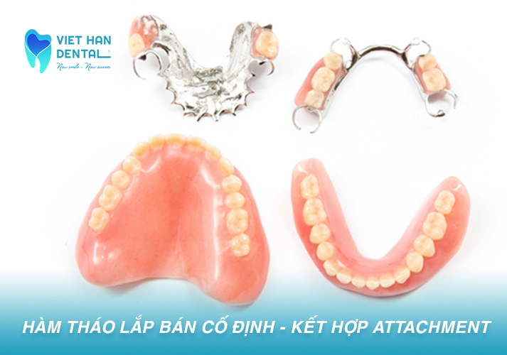 Ham Thao Lap Ban Co Dinh Ket Hop Attachment
