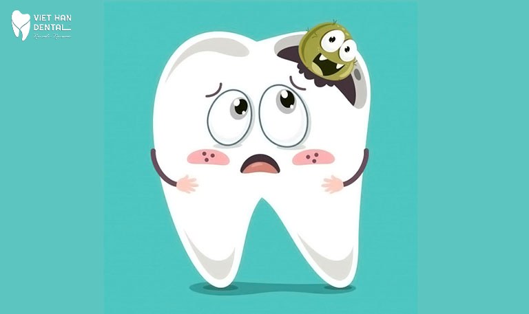 Sâu răng là một trong những nguyên nhân gây bệnh hôi miệng 