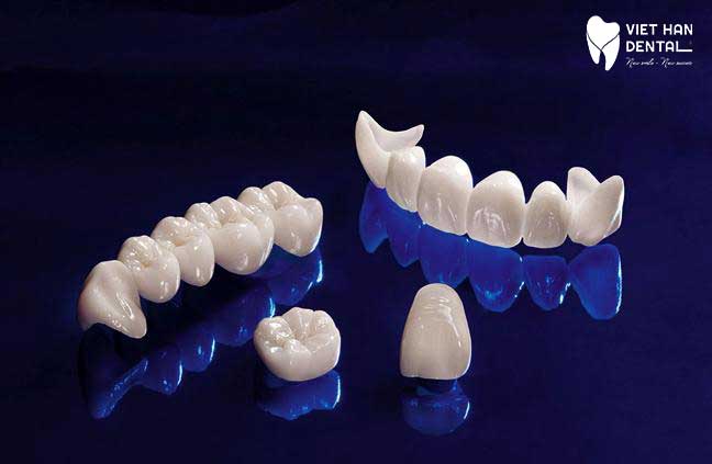 Chất liệu răng sứ có ảnh hưởng đến tuổi thọ của chúng 