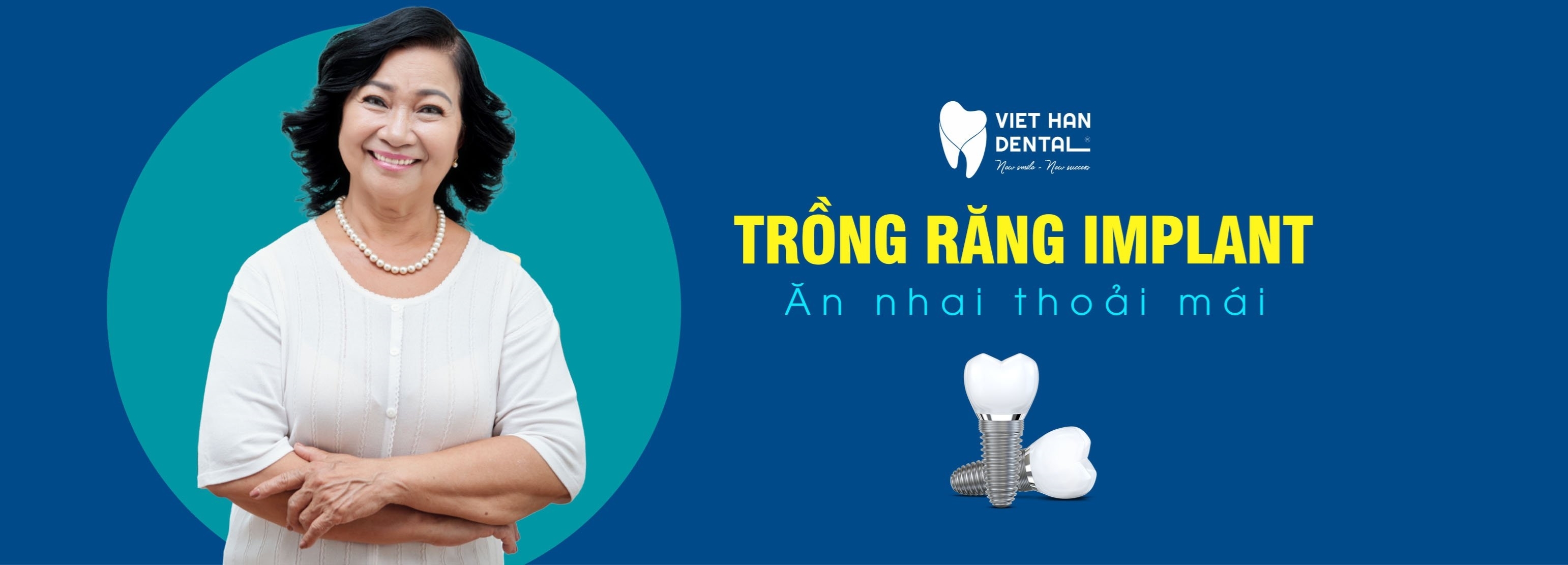 Trồng Răng Implant All-On-4